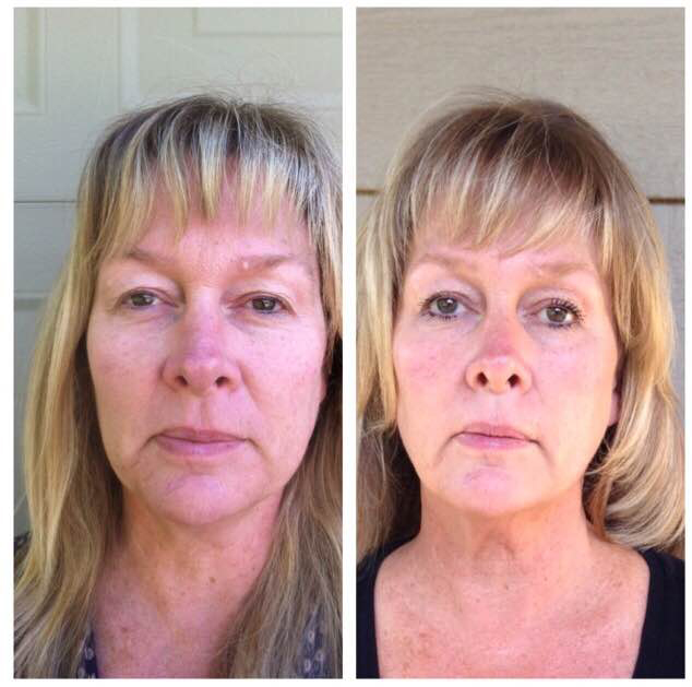 Nerium, Nerium skincare, how to use Nerium, Nerium results, before and after using Nerium, staying young, young skin, younger looking skin, stay youthful, prevent fine lines, prevent aging, anti-aging