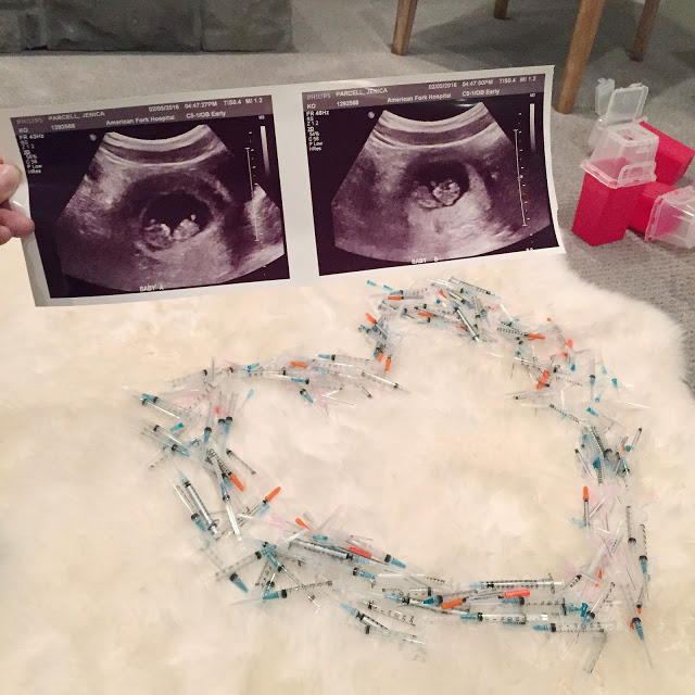 IVF process featured by top fertility blog, A Slice of Style: image of 2 baby scans